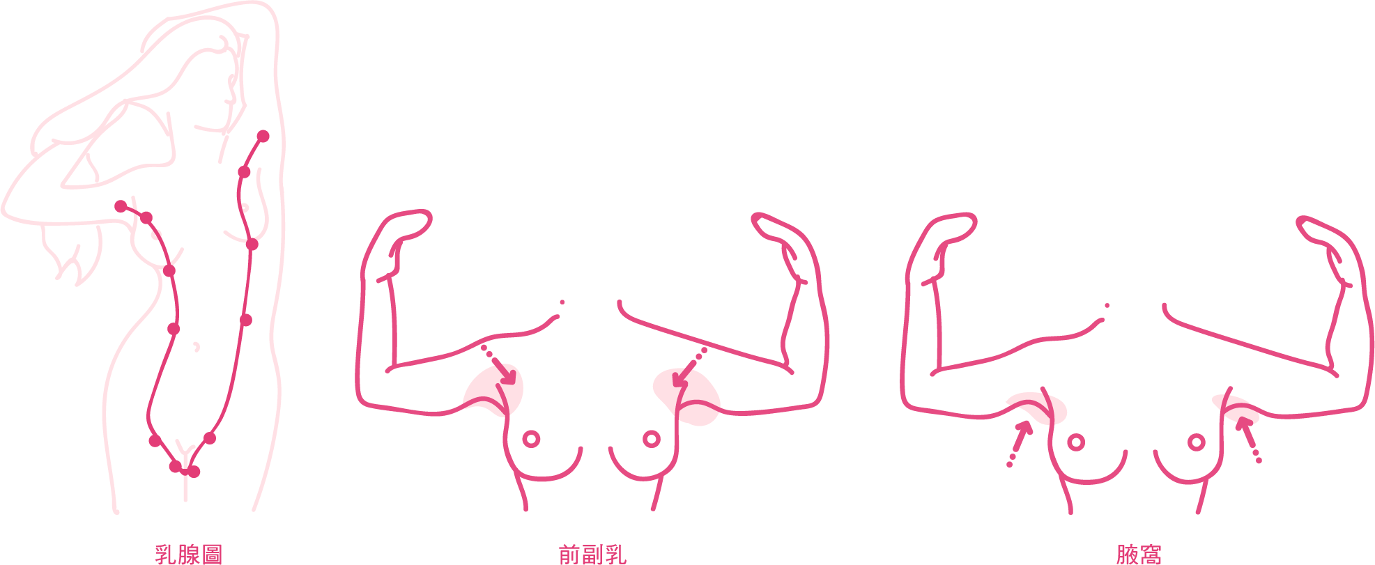 乳腺圖 前副乳 腋窩